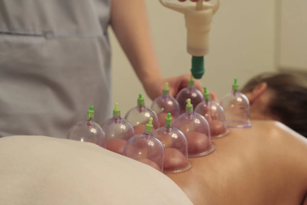 Cupping therapy for stress and tension relief